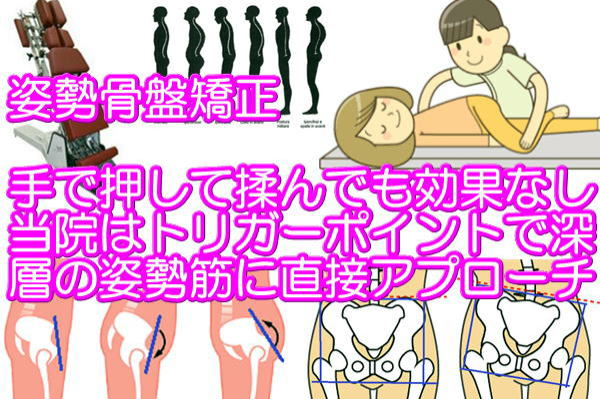 骨盤矯正姿勢矯正猫背矯正名張市整骨院